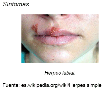 Frenillo de los labios menores - Wikipedia, la enciclopedia libre